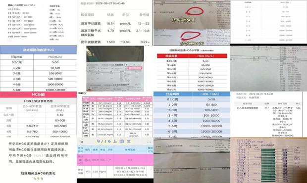 hCG值是9正常吗 - 汕头hcg值多少是宫外孕
