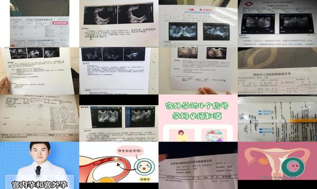 怀孕多少天才能生宝宝 - 汕头怀孕多久才知道是宫外孕