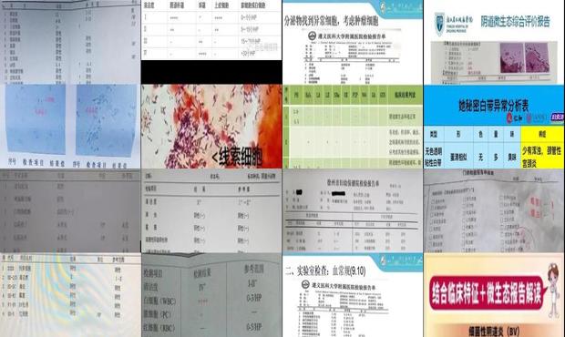 汕头阴道分泌物常规检查