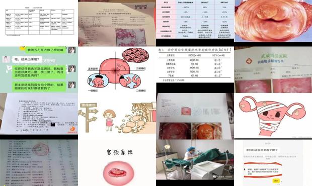 医院做宫颈糜烂多少钱 - 汕头做宫颈糜烂手术价格表