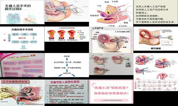 汕头妇产医院无痛人流多少钱 - 汕头无痛人流步骤