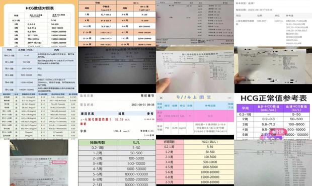 汕头宫外孕手术哪里医院比较好 - 汕头宫外孕hcg能达到多少