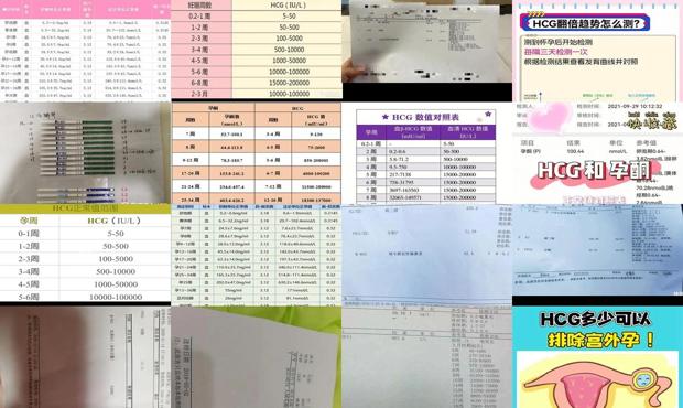hcg血检结果多少正常 - 汕头血hcg多少排除宫外孕